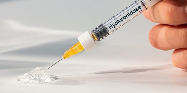 Hialuronidase guiada por Ultrassom